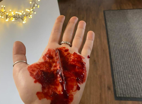 A hand made to look as though it has glass stuck in it for the purpose of training.
